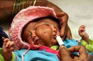indianbabygod04 300x196 Bebê com duas caras vira atração na Índia
