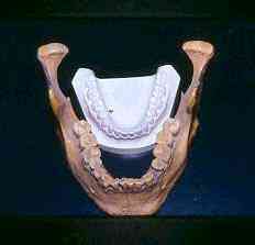 Monstros gigantes? Isto é incrível lovelock dentes | Curiosidades | Arqueologia, criaturas, criptozoologia, dinossauros, gigantes, Loch Ness, monstros, Monstros marinhos