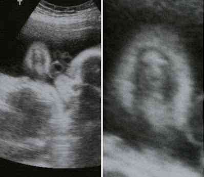 Coisas curiosas que você não pode nem imaginar jesus baby scan ultrasound | Curiosidades | curioso, incrível, religião