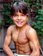 Hiper musculatura sandrak | Bizarro | bizarrice, incrível, medicina, mutante, noticias