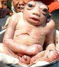 Estranhas mutações e imagens grotescas freakbaby | Bizarro | bizarro, doenças, estranhos, nojento, notícia, sinistro