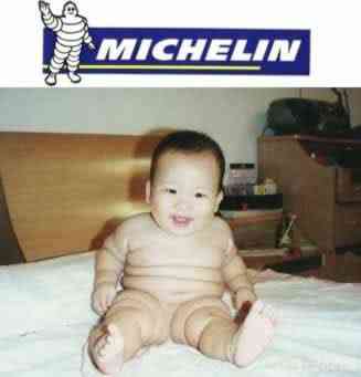 Estranhas mutações e imagens grotescas michelin baby | Bizarro | bizarro, doenças, estranhos, nojento, notícia, sinistro