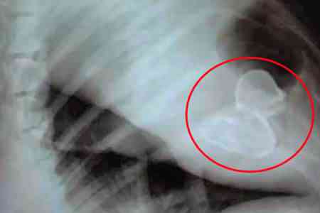 xrayrubberduck_450x300 | Animais | animais, cachorro, curioso, incrível, sinistro