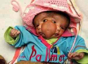 indianbabygod01 indianbabygod01 | Bizarro | bizarro, curioso, doença, doenças, índia, mutante, notícia, noticias, sinistro