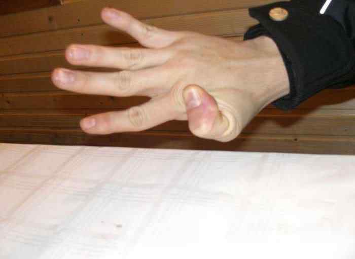 Pessoas de borracha finger tricks 03 | Bizarro | absurdo, Arte, bizarro, curioso, estranho, horrível, incrível, medicina, nojento, sinistro