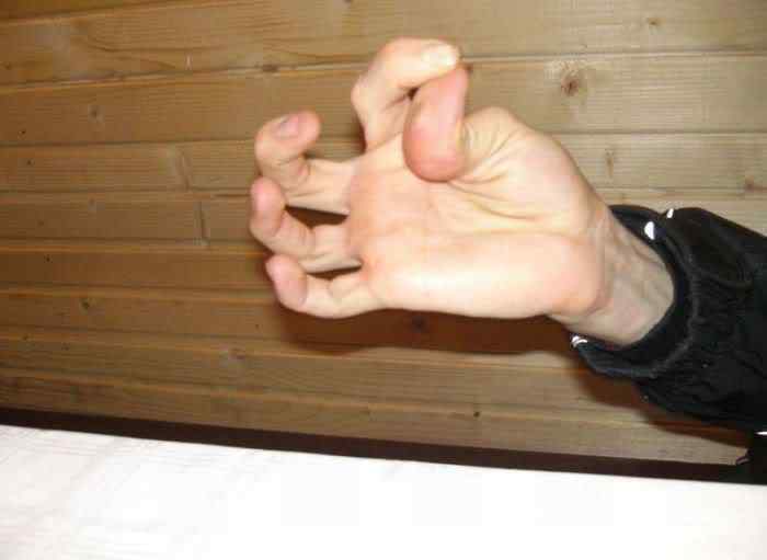 Pessoas de borracha finger tricks 04 | Bizarro | absurdo, Arte, bizarro, curioso, estranho, horrível, incrível, medicina, nojento, sinistro