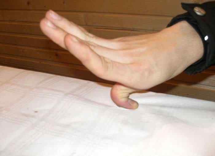 Pessoas de borracha finger tricks 05 | Bizarro | absurdo, Arte, bizarro, curioso, estranho, horrível, incrível, medicina, nojento, sinistro