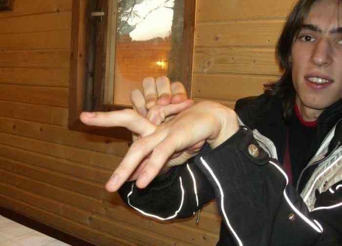 Pessoas de borracha finger tricks 08 | Bizarro | absurdo, Arte, bizarro, curioso, estranho, horrível, incrível, medicina, nojento, sinistro