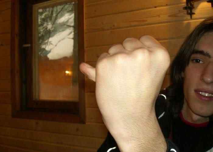 Pessoas de borracha finger tricks 11 | Bizarro | absurdo, Arte, bizarro, curioso, estranho, horrível, incrível, medicina, nojento, sinistro