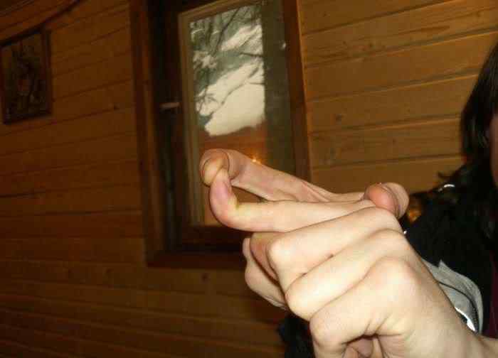 Pessoas de borracha finger tricks 12 | Bizarro | absurdo, Arte, bizarro, curioso, estranho, horrível, incrível, medicina, nojento, sinistro