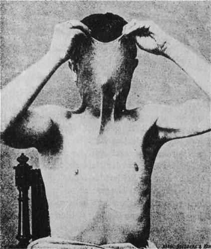 Pessoas de borracha rubber man | Bizarro | absurdo, Arte, bizarro, curioso, estranho, horrível, incrível, medicina, nojento, sinistro