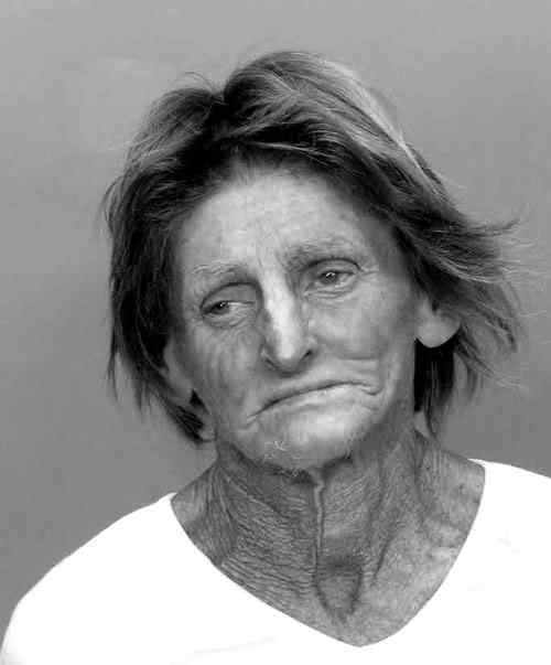 Drogada e prostituída PQbXjg8Gqmncni00md9FHrOto1 500 | Bizarro | doença, drogas, feio, horrível, sinistro