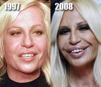 Celebridades ontem e hoje 500full donatella versace | Curiosidades | bizarro, celebridades, curioso, feio, idade, velho