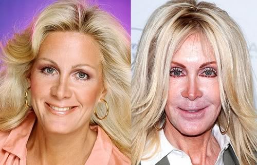 Celebridades ontem e hoje 500full joan van ark | Curiosidades | bizarro, celebridades, curioso, feio, idade, velho