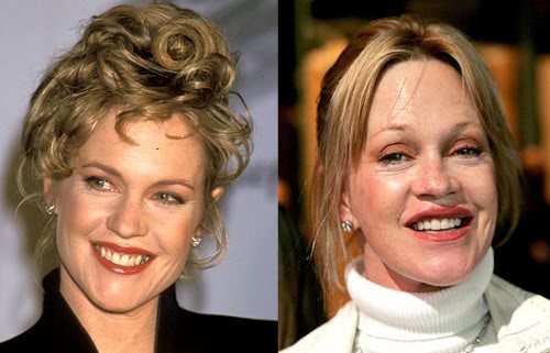 Celebridades ontem e hoje 500full melanie griffith | Curiosidades | bizarro, celebridades, curioso, feio, idade, velho