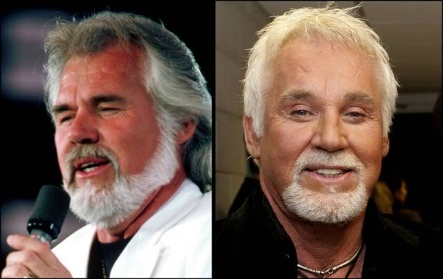 Celebridades ontem e hoje aging stars 08 | Curiosidades | bizarro, celebridades, curioso, feio, idade, velho