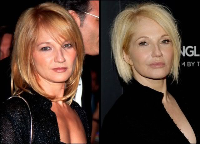 Celebridades ontem e hoje aging stars 11 | Curiosidades | bizarro, celebridades, curioso, feio, idade, velho