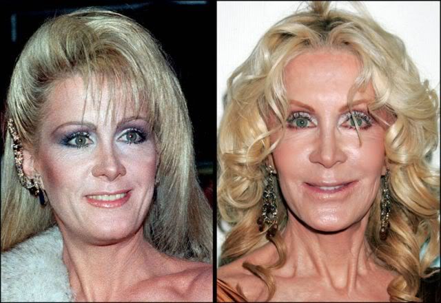 Celebridades ontem e hoje aging stars 14 | Curiosidades | bizarro, celebridades, curioso, feio, idade, velho