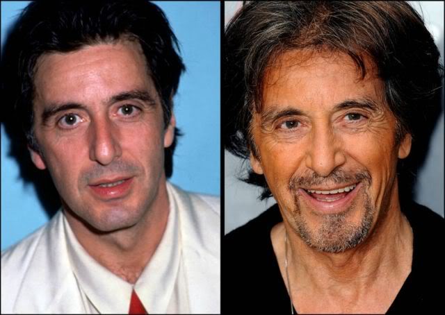 Celebridades ontem e hoje aging stars 15 | Curiosidades | bizarro, celebridades, curioso, feio, idade, velho