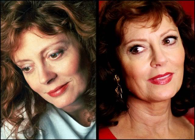 Celebridades ontem e hoje aging stars 16 | Curiosidades | bizarro, celebridades, curioso, feio, idade, velho