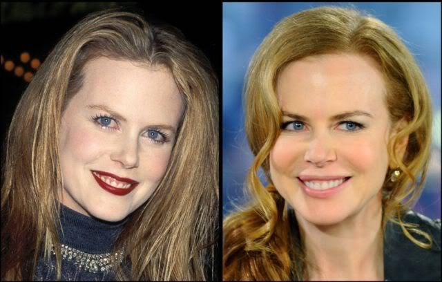 Celebridades ontem e hoje aging stars 23 | Curiosidades | bizarro, celebridades, curioso, feio, idade, velho
