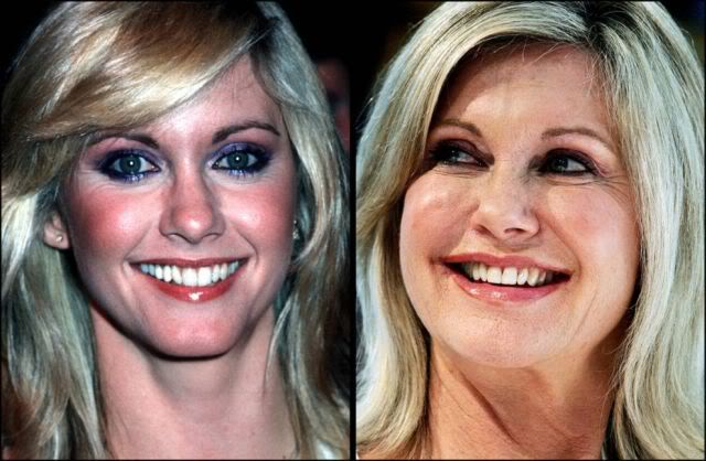 Celebridades ontem e hoje aging stars 24 | Curiosidades | bizarro, celebridades, curioso, feio, idade, velho