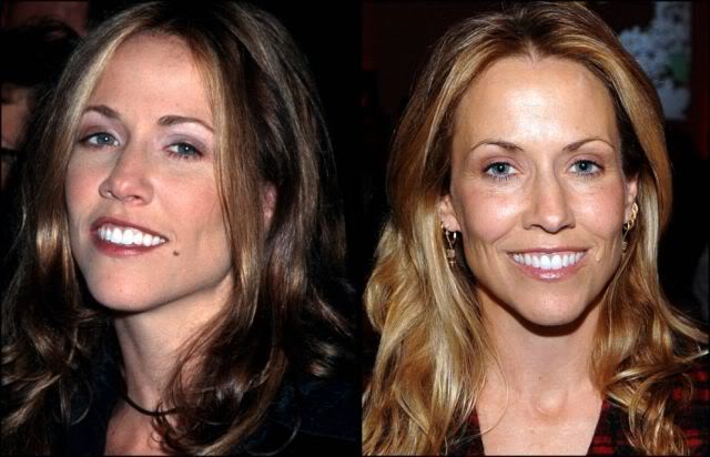 Celebridades ontem e hoje aging stars 27 | Curiosidades | bizarro, celebridades, curioso, feio, idade, velho