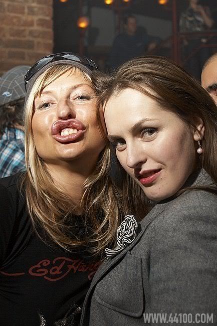 Duckface: Por que as pessoas fazem esta expressão ridícula? Photobucket