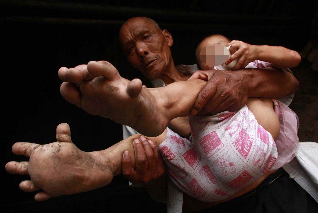 Estranhas condições físicas yuyu feet story china