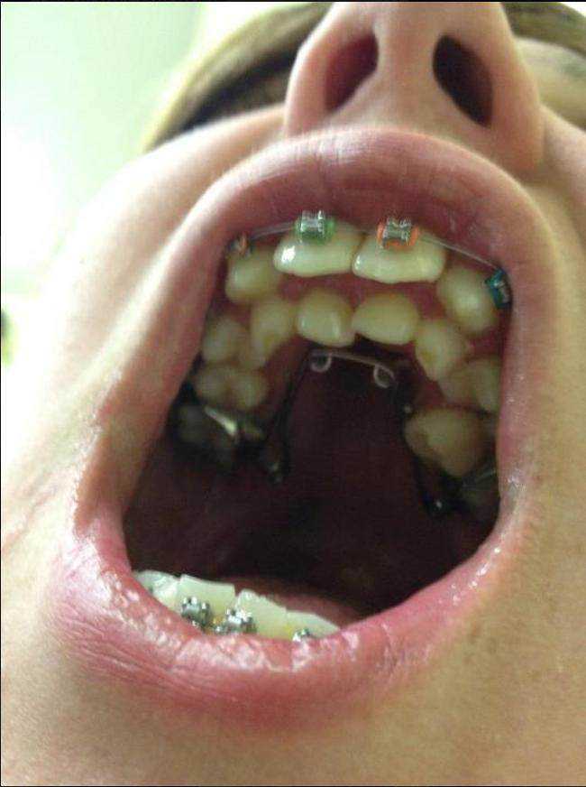 15 bizarrices envolvendo dentes 02dc972c12ed12bcb0aa63544b1943c6