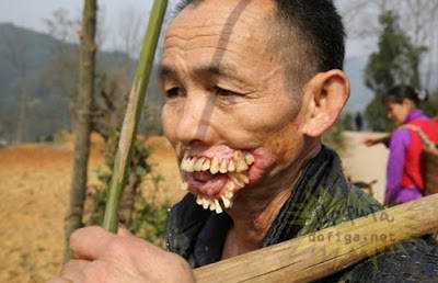 15 bizarrices envolvendo dentes 1 (2)