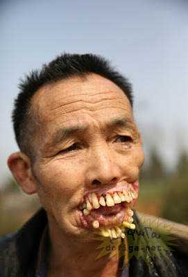 15 bizarrices envolvendo dentes 2 (2)