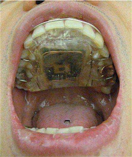 15 bizarrices envolvendo dentes 2a6575f6a85b84740c6be306bfebbaa9