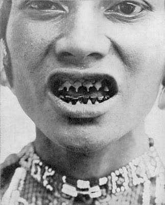 15 bizarrices envolvendo dentes 33526fee7c0bd393762cced5aa816e2d