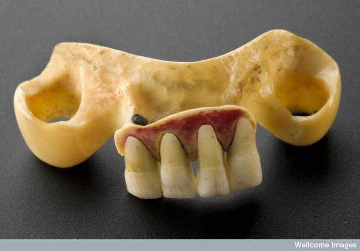 15 bizarrices envolvendo dentes 4265ed561393eb5d35d0c0e28268720a
