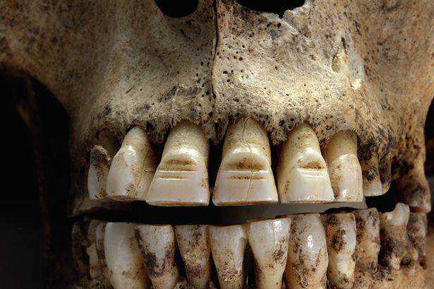 15 bizarrices envolvendo dentes 6377811d24cbc99856076b4f90e689b2