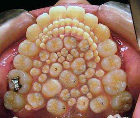 15 bizarrices envolvendo dentes 942047_10151586591727025_104002028_n