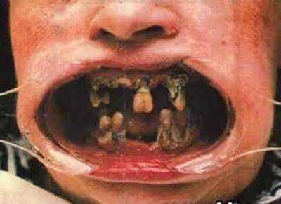 15 bizarrices envolvendo dentes a971cb609c4061606f297b4f9c02167f