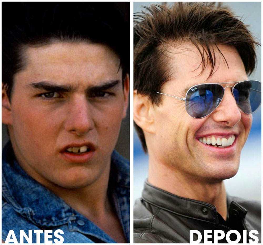 15 bizarrices envolvendo dentes dentes-tomcruise
