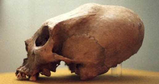 Crânios bizarros - Encontrado o crânio do pé grande? elongated_skull.img_assist_custom