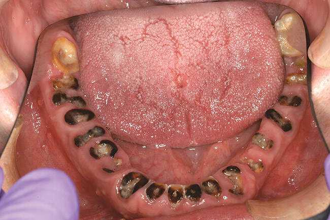 15 bizarrices envolvendo dentes figure_3_lg