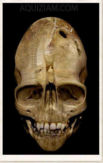 Crânios bizarros - Encontrado o crânio do pé grande? weird-skull