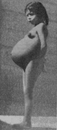 Os mais gumpmente incríveis casos de gravidez Lina_Medina_grávida