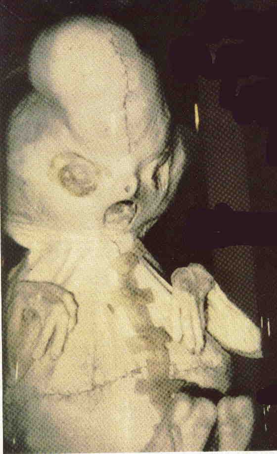 Os mais gumpmente incríveis casos de gravidez monster1
