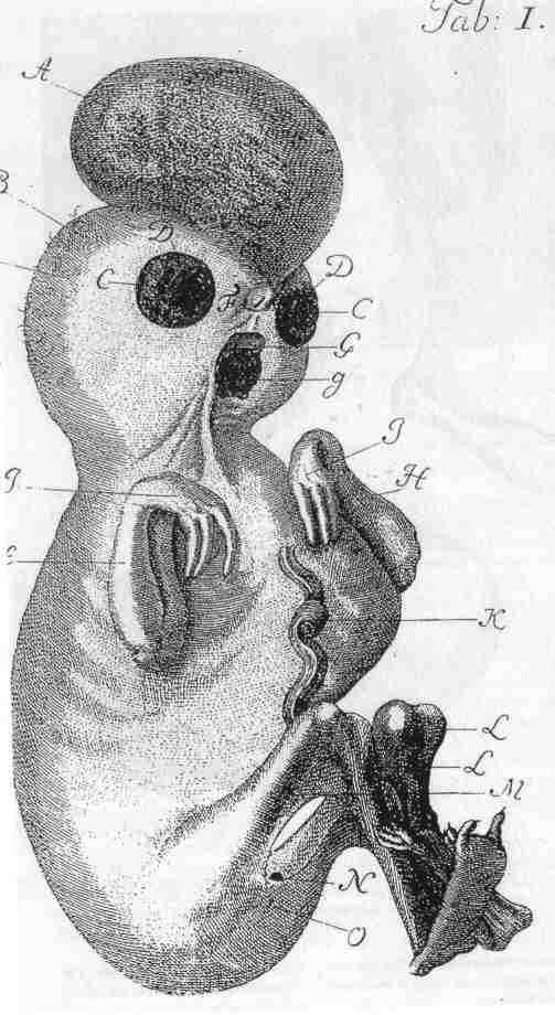 Os mais gumpmente incríveis casos de gravidez monster3