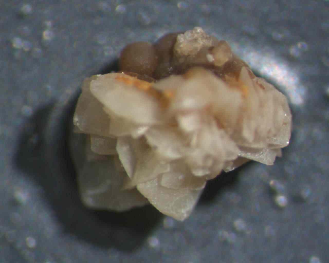 Mais uma pedra nos rins para a minha coleção Pensa só na delicia que é ter essa coisa cheia de faquinhas descendo pelo seu ureter! (essa não é minha pedra)
