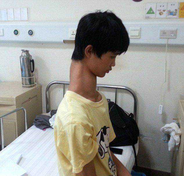 Conheça o chinês que tem um pescoço gigante 7dd8de3fed4ff4089ea57dbfd498726b