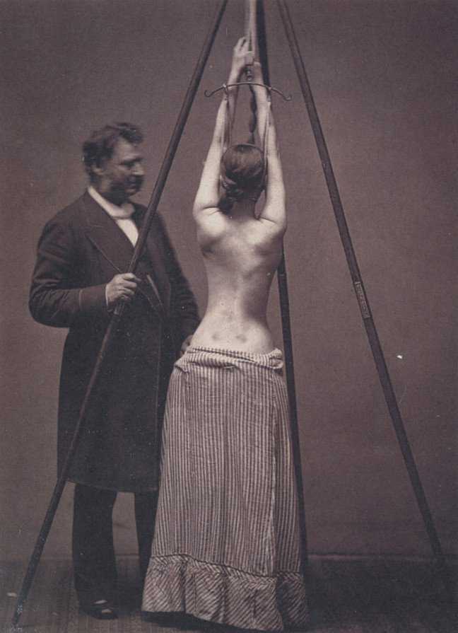 Fotos da medicina antiga que são assustadoras e fascinantes 19462a89e9c598435c3962b68b8b9c92