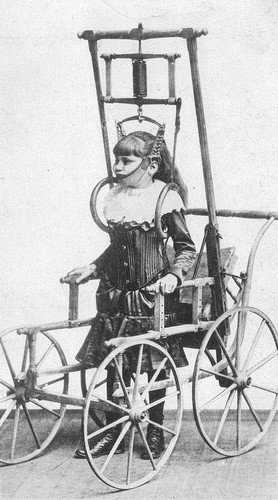 Fotos da medicina antiga que são assustadoras e fascinantes 1_b3a9c34e-72c0-4437-afa9-6ee20be4517e