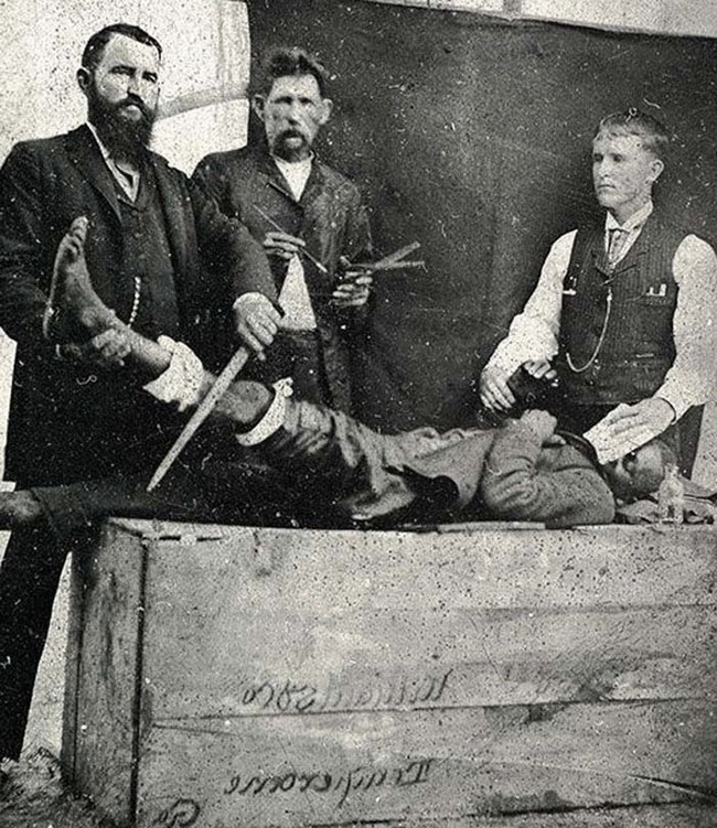 Fotos da medicina antiga que são assustadoras e fascinantes 9a096b161ac06556ab0cd2e92caa3895